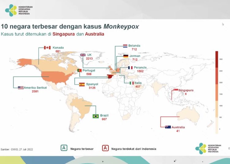 Belum Ditemukan Kasus Konfirmasi Cacar Monyet di Indonesia